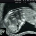 Unternehmen 10 Bild FRAUENARZTPRAXIS AM POTSDAMER PLATZ BERLIN Ärzte am Berlin BE