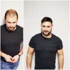 Unternehmen 6 Bild HAARZENTRUM KEIL OHG Perückenstudios am Rodgau HE