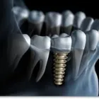 Unternehmen 9 Bild HERR DR. KLAUS HUBER MÜNCHEN Ärzte am München BY