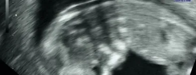 Unternehmen 10 Bild FRAUENARZTPRAXIS AM POTSDAMER PLATZ BERLIN Ärzte am Berlin BE